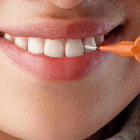 Ершики межзубные Revyline Smart, размер 1 (0,45 мм) оранжевые, 6 шт.